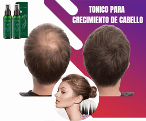 Elhoe Spray Capilar para Crecimiento y Fortalecimiento del Cabello